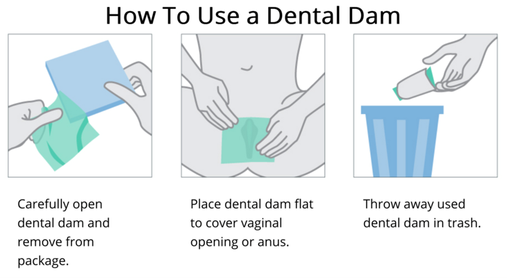 Three step how to on how to use a dental dam