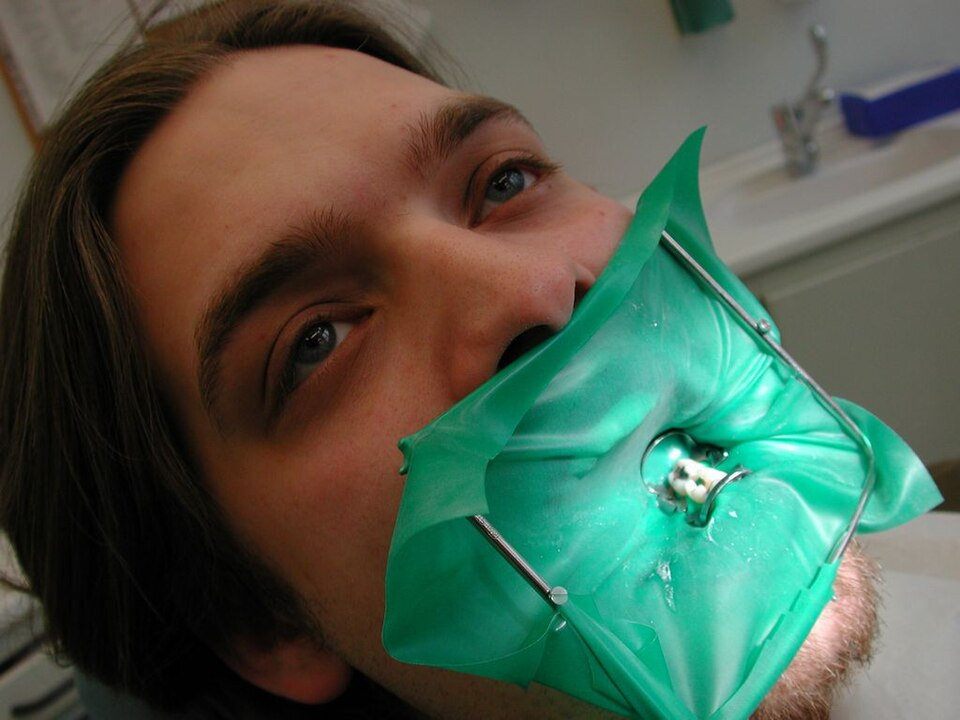 image of person with dental dam in mouth during oral surgery